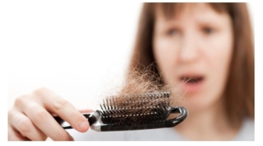 COVID 19 and Growing Problems of Hair Loss